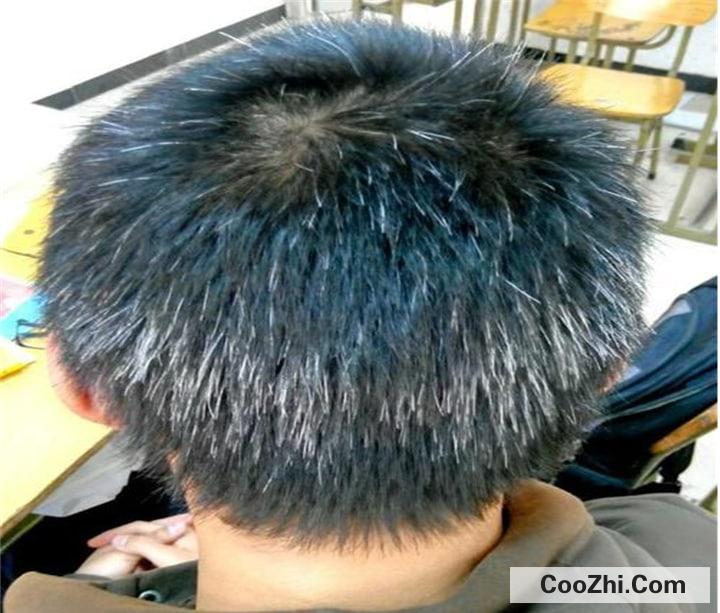 ���ư׷����ط�����